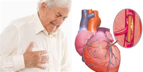 Tips menjaga kesehatan tubuh secara alami Penyakit Jantung Bukan Iskemik